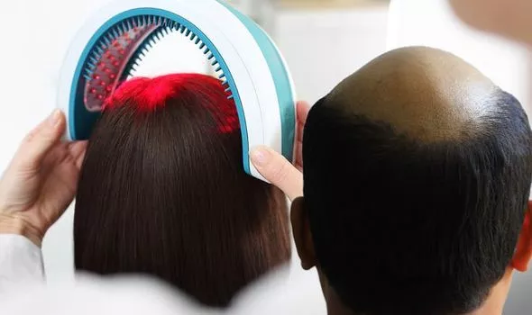 Hair Loss Treatment
